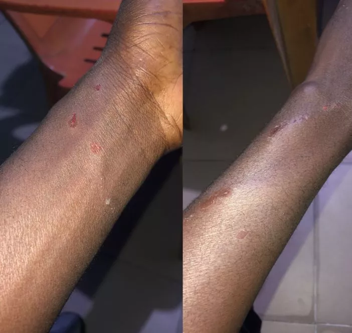 'I go too flog this dog', man reacts to his dog biting him