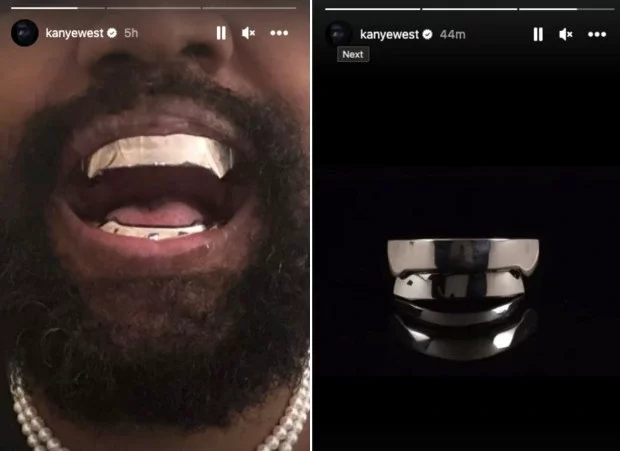 Top dentist reveals the huge problem with Kanye West