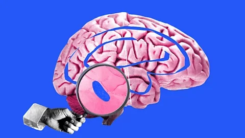 Serenity Strull/BBC/Getty Images An illustration showing the locus coeruleus's location in the brain (Credit: Serenity Strull/BBC/Getty Images)