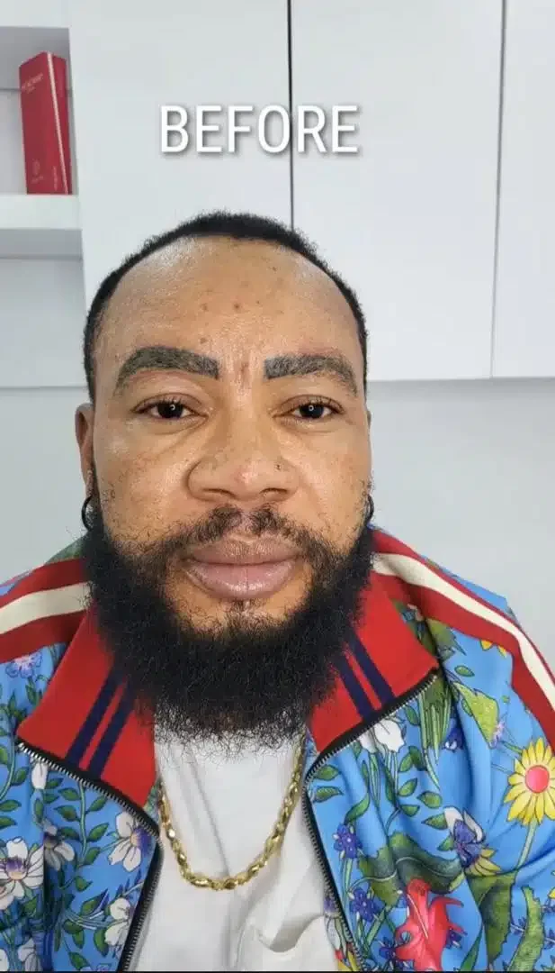 Man shares transformation following facial and weight loss procedures