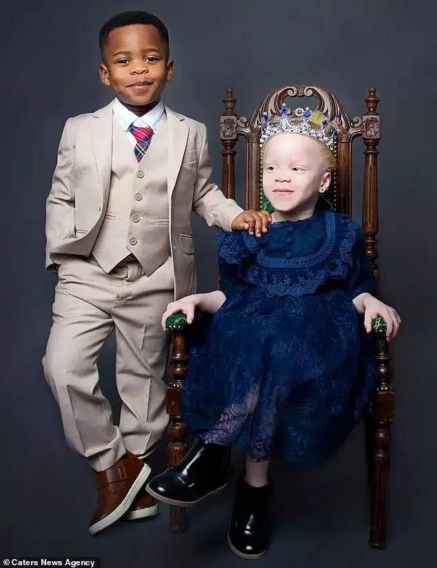 'People don't believe they are twins' - Nigerian mum flaunts albino daughter and her dark-skinned brother (Photos)