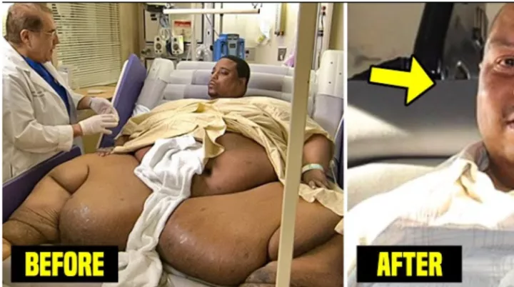Remember This Man Who Weighed 1022 Pounds? This Is How He Looks Now (Video)