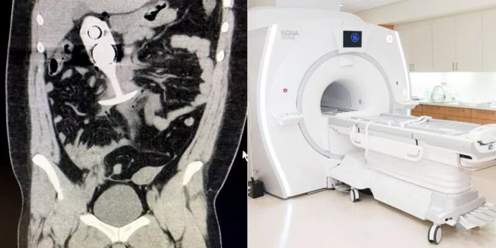 Woman suffers major injuries after 'mistakenly' wearing a sex toy to an MRI scan