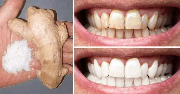 10 natural methods to whiten your teeth at home