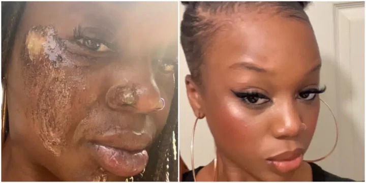 'This is unbelievable' - Nigerian lady stuns many as she shares photo of her face after surviving a fatal car accident