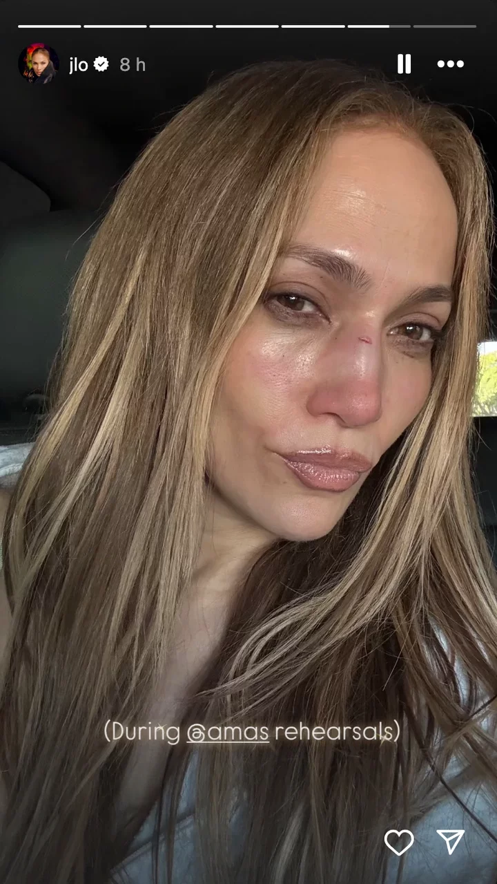 Jennifer Lopez gives health update after onstage injury that led to facial 'stitches' Jennifer Lopez gives health update after onstage injury that led to facial 'stitches'