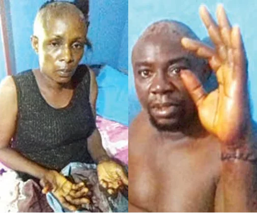 Rivers landlord allegedly hacks couple with machete after the woman 'refused his advances'