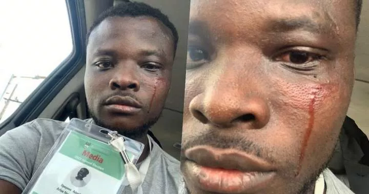 2023 Election: Journalist injured by thugs at Elegushi Palace