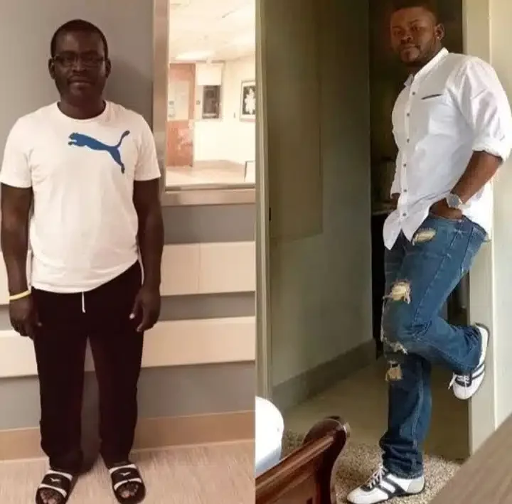 It affected my relationship with ladies - Short man undergoes painful surgery to increase his height (Photos)