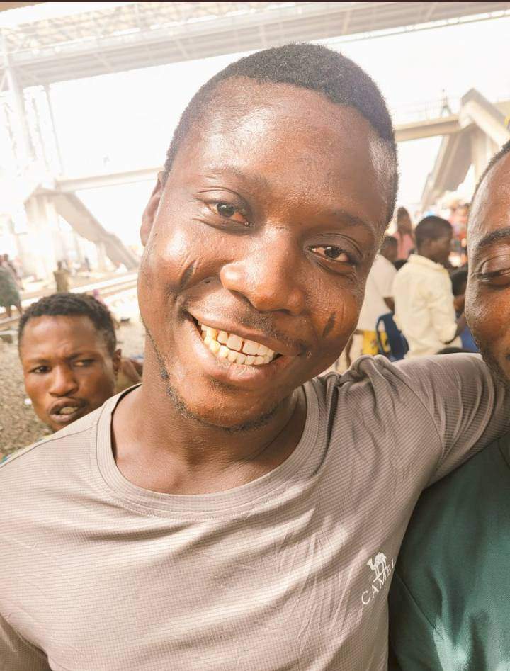 Man who felt insecure about his teeth can't stop smiling after a philanthropist took him to a dentist (Photos)