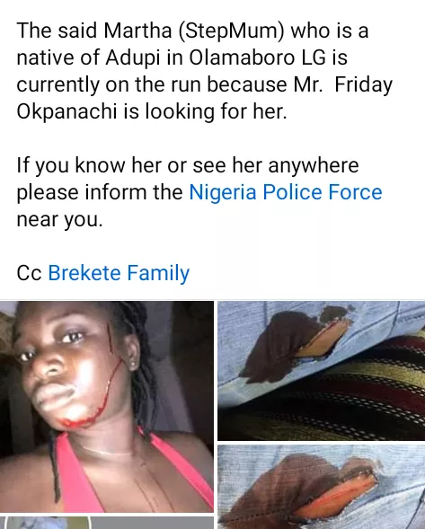 Kogi woman accused of slashing her stepdaughter's face and thigh with razor blade