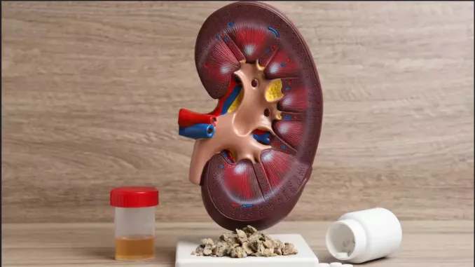 You Are Killing Your Kidney With These 5 Habits