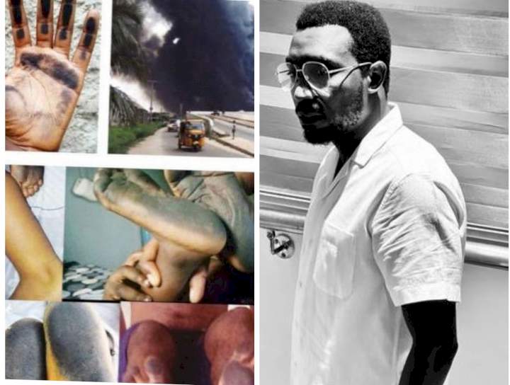 "Let's not sit back and keep quiet" - Singer Timi Dakolo raises alarm over surge of black soot in Port Harcourt