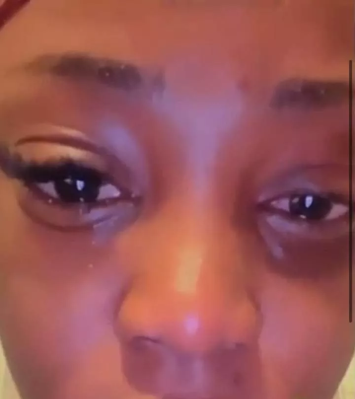 Lady almost loses an eye after fixing eyelash extension (Video)