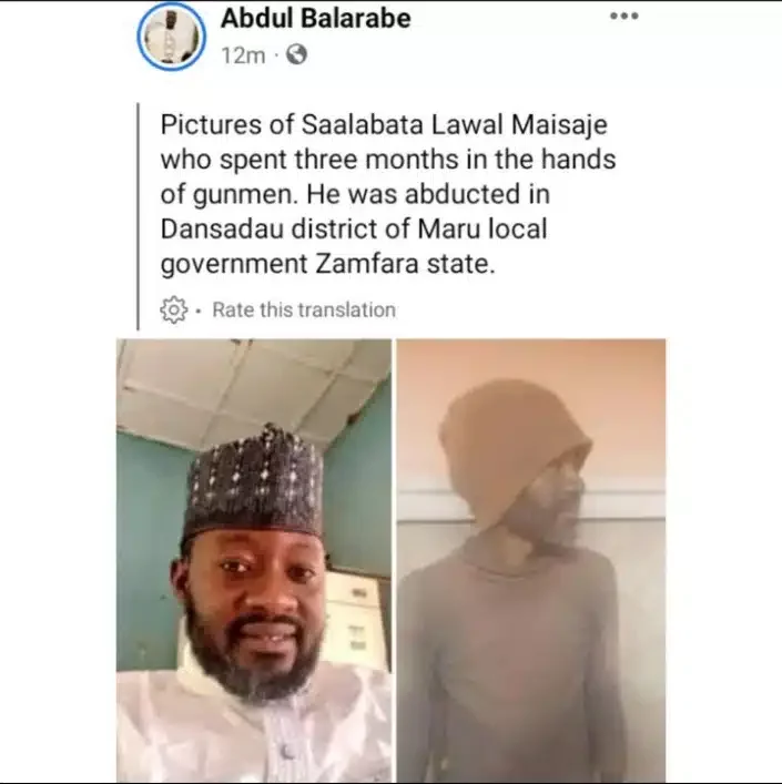 Before and after photos of man who regained freedom from gunmen after 3 months in captivity