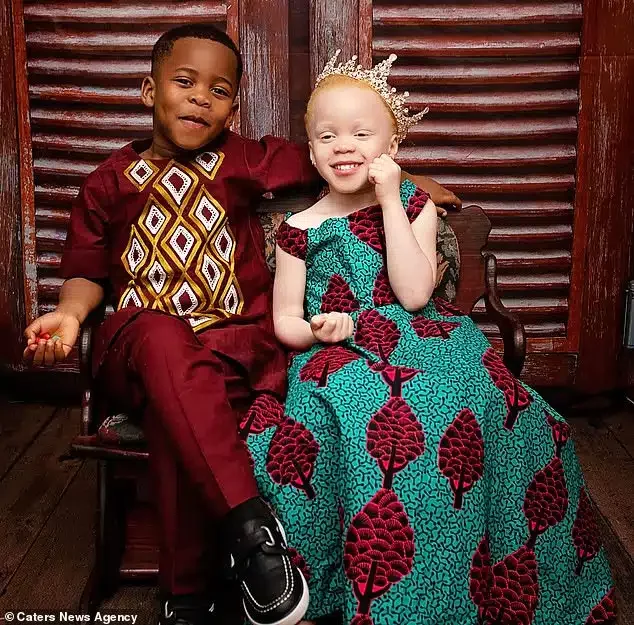 'People don't believe they are twins' - Nigerian mum flaunts albino daughter and her dark-skinned brother (Photos)