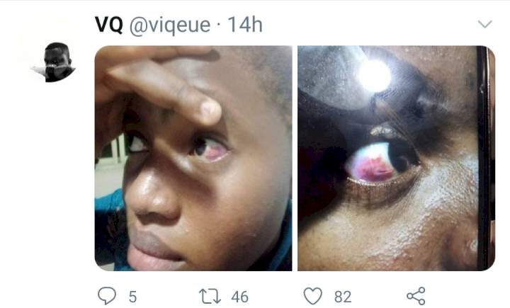 Woman bleeds from the eye after a LASTMA official allegedly assaulted her