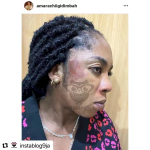 How God kept my baby alive in my womb for 8hrs after I almost d#ed on the way to the hospital - Actress Amarachi Igidimbah