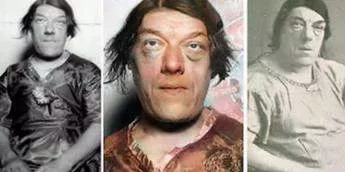 Mary Ann Bevan won an 'ugliest woman in the world' competition [Fact Issues]
