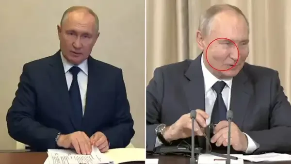 Vladimir Putin's swollen 'butt filler' cheeks spark more plastic surgery rumours