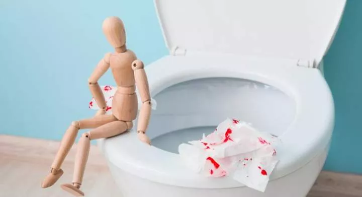 5 reasons you might see blood in your poop