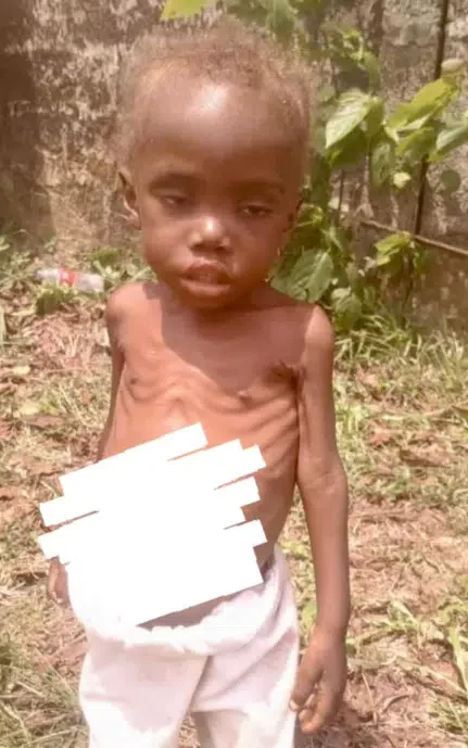 Amazing transformation of toddler who was rescued after being abandoned as a 'witch' goes viral