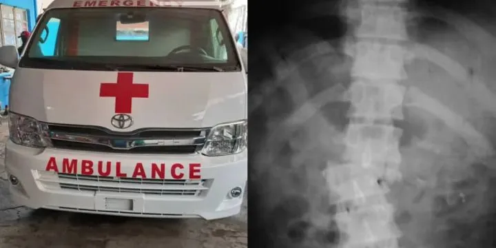 Cultist allegedly breaks student's spine for refusing to give him her phone number Cultist allegedly breaks student's spine for refusing to give him her phone number
