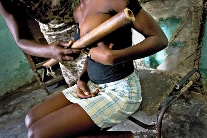 Breast ironing: culture that defies modernism