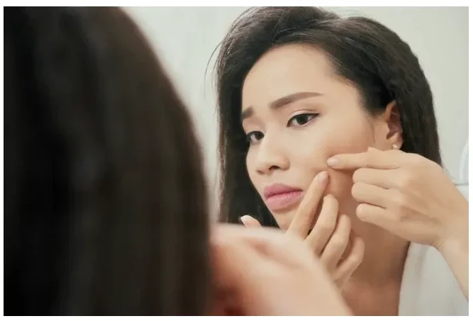 7 Things That Cause Pimples You Need To Stop Doing