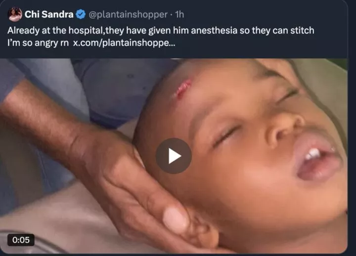 Mother cries out over scar on son inflicted by classmate at school