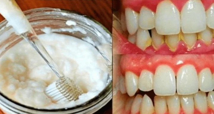 A Simple Way to Get Rid of Bad Breath and Get Rid of Mouth Bacteria