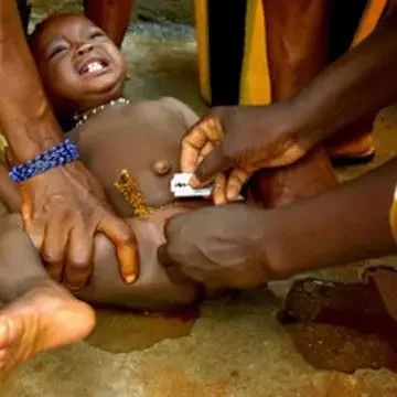 The horrors of female genital mutilation and infibulation