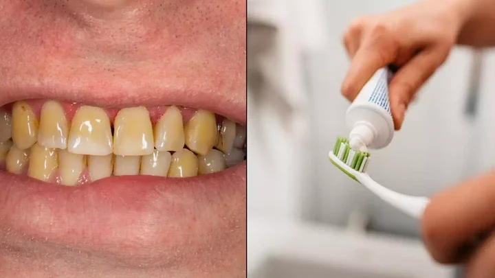 Dentist shares the seven main reasons your teeth go yellow and ways to stop it happening