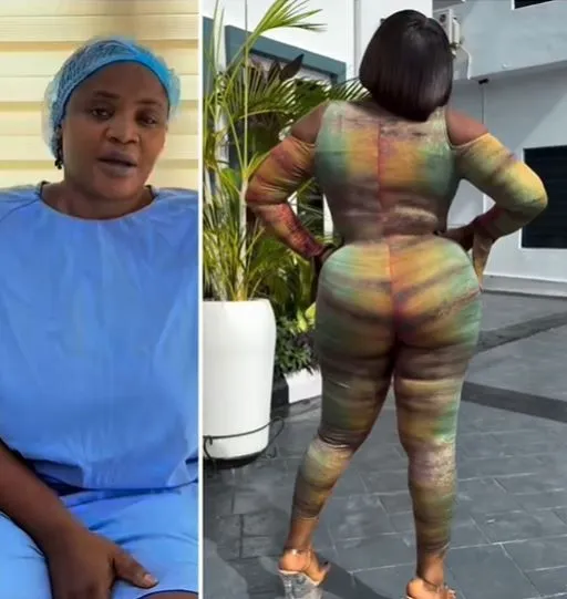 Nollywood Actress, Uche Ogbodo Debuts Her New Body Weeks After Going Under The Knife For A BBL Surgery (Video) Nollywood Actress, Uche Ogbodo Debuts Her New Body Weeks After Going Under The Knife For A BBL Surgery (Video)