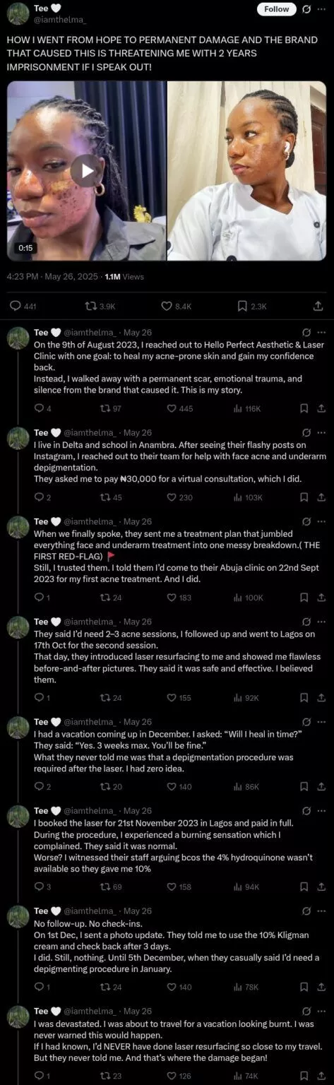 Clinic allegedly vows to jail lady for speaking out after acne treatment results in permanent scar