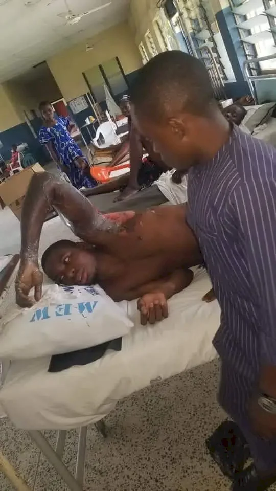 AKSU student hospitalized after he was allegedly set ablaze by community resident amid fierce argument