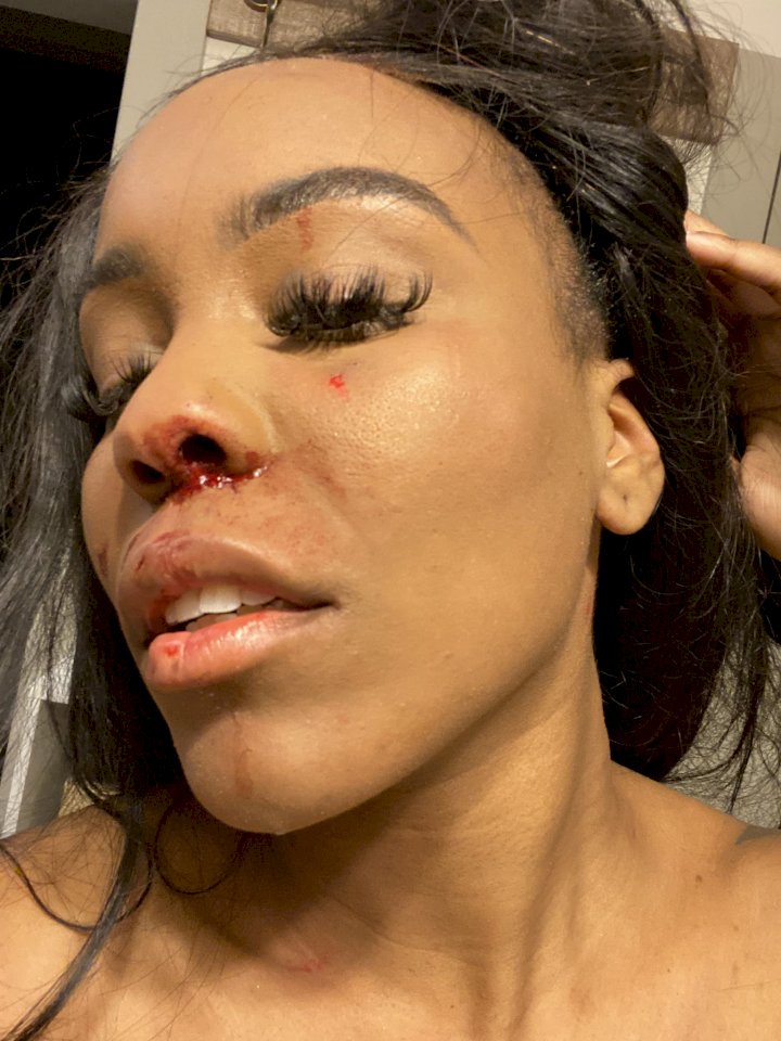 'Domestic violence is real especially in same gender relationship' - Lady cries out after being battered by her girlfriend