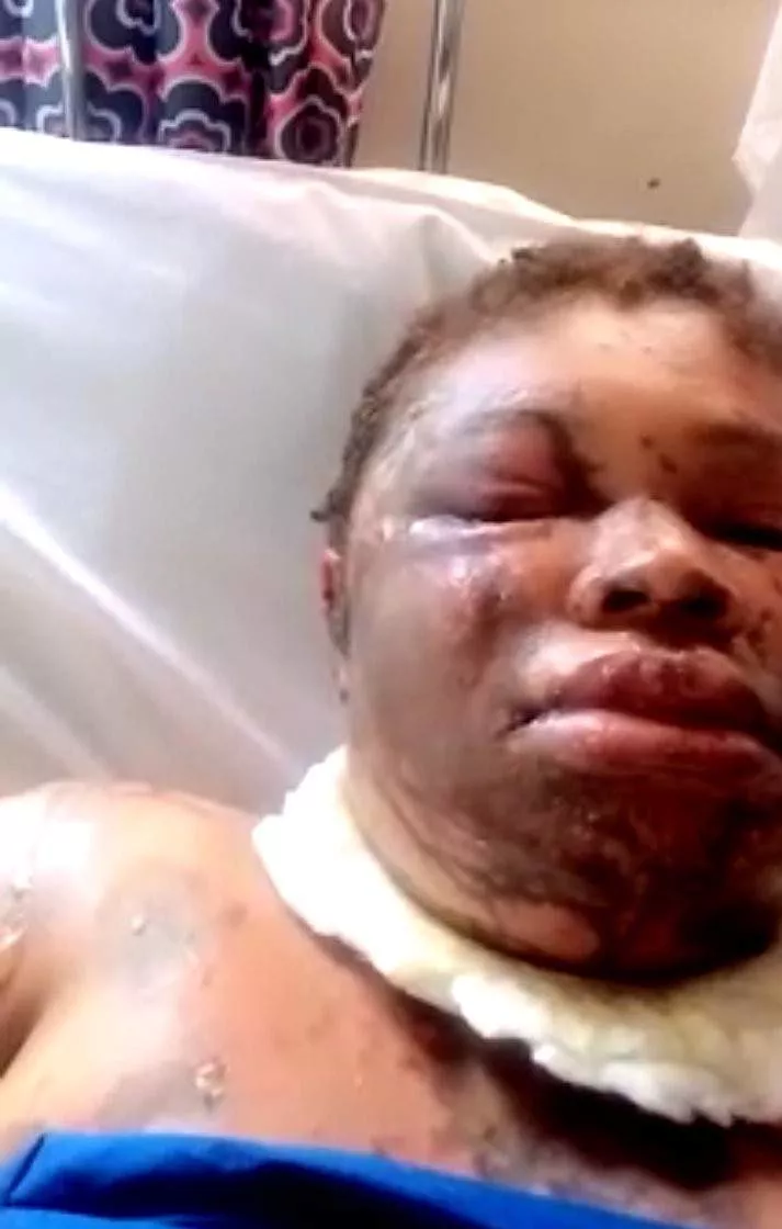 Man reportedly pours acid on his wife in Rivers