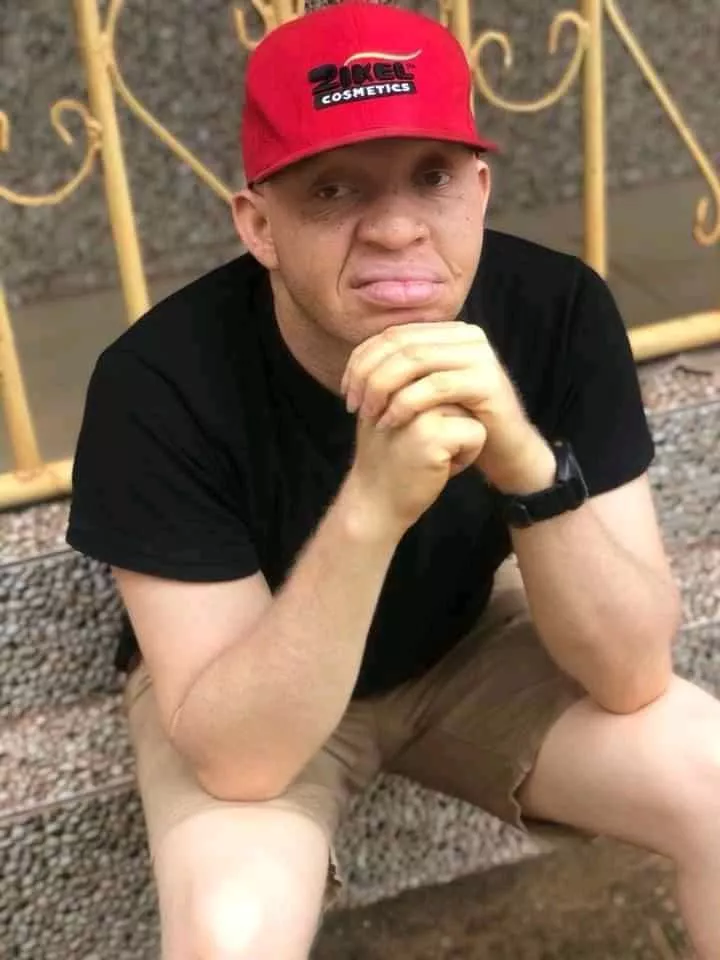 Don't come near me with that rubbish mentality - Nigerian man warns people who say albinos have Iow self esteem because of their skin color