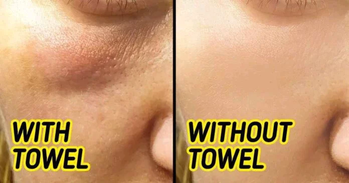 See Reasons Why You Shouldn't Use a Towel to Dry Your Face