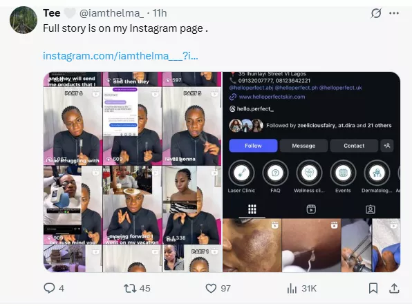Lady accuses aesthetic clinic of permanent scar following skincare treatment