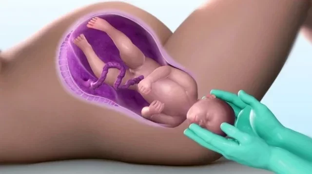 What The Female Organ Goes Through During Childbirth