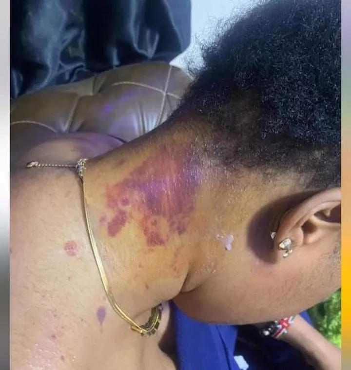 Portable's wife Bewaji reacts to domestic violence accusations after photos of battered body surfaced online