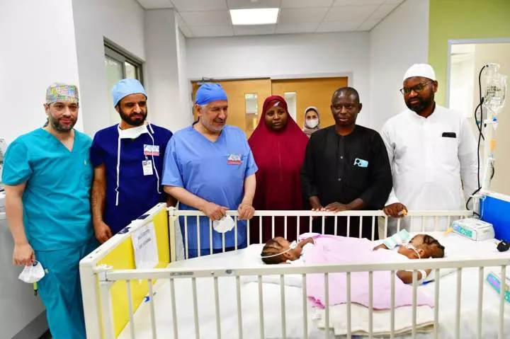 Saudi medical team separates Kano conjoined twins