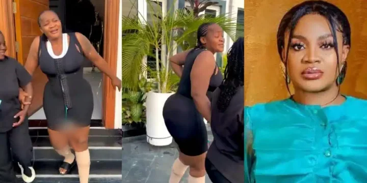Uche Ogbodo shares recovery video after undergoing plastic surgery