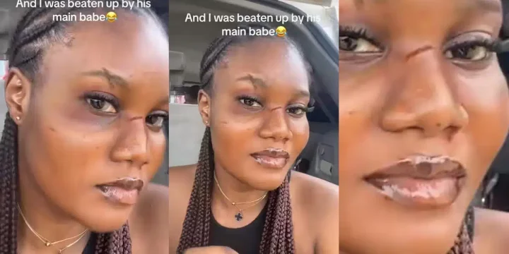 Nigerian lady gets her face redesigned by boyfriend's main girlfriend after unannounced visit to his house