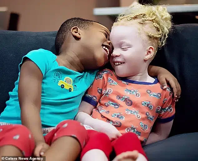 'People don't believe they are twins' - Nigerian mum flaunts albino daughter and her dark-skinned brother (Photos)