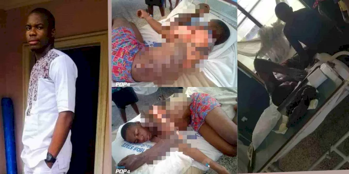 AKSU student hospitalized after he was allegedly set ablaze by community resident amid fierce argument