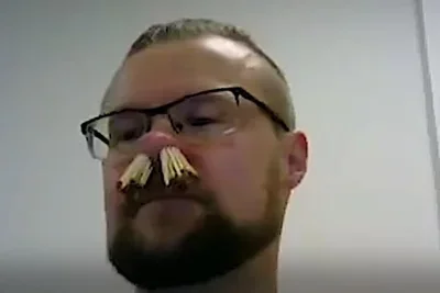 Man Sticks 68 Matches In His Nose To Break Guiness World Record