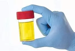 Urine Colors Explained